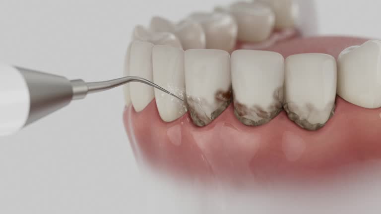 Trusted Teeth Whitening service in Byng, OK - Dentist Open Now